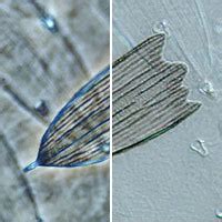 Comparison of Phase Contrast & DIC Microscopy | Nikon’s MicroscopyU