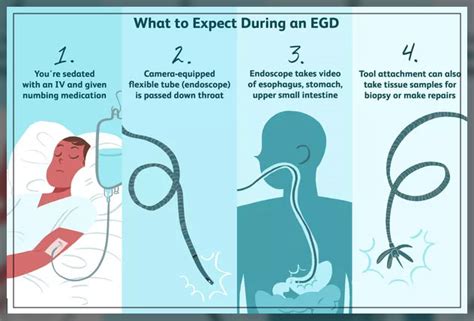 Endoscopy Procedure, Uses, and Types - Engiomed