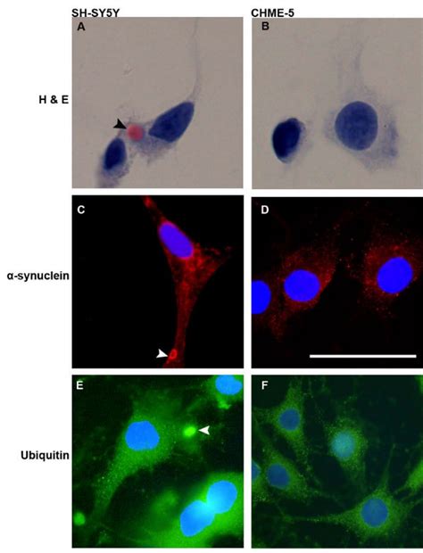 Detection of inclusion bodies. Representative photomicrographs showing ...