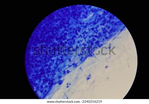 Mycobacterium Tuberculosis Appearance Under Microscope Red Stock Photo ...