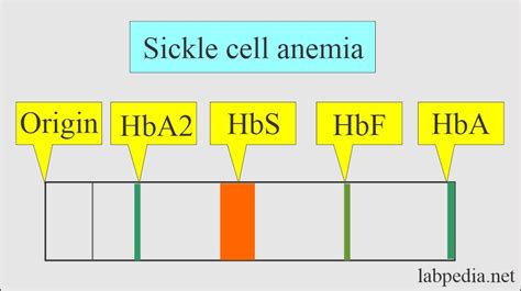 Hemoglobin:- Part 2 - Hemoglobin Electrophoresis, (Hb electrophoresis ...