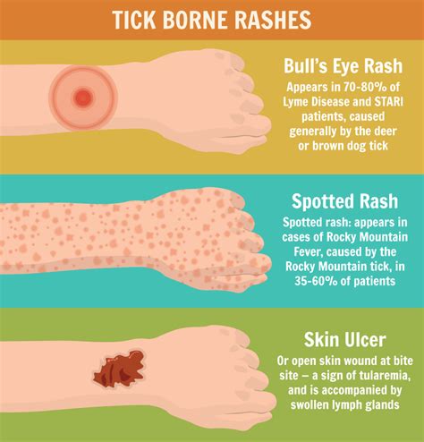 Here's What You Need To Know About Ticks