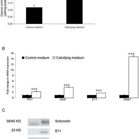 Up-regulation of osteocyte markers during in vitro calcification of... | Download Scientific Diagram