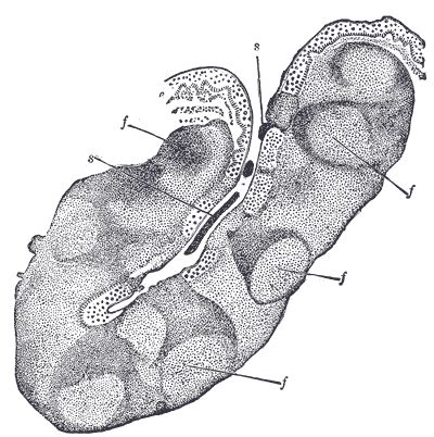 Palatine tonsil - Wikiwand