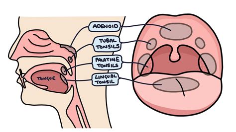 Tonsillitis – Zero To Finals