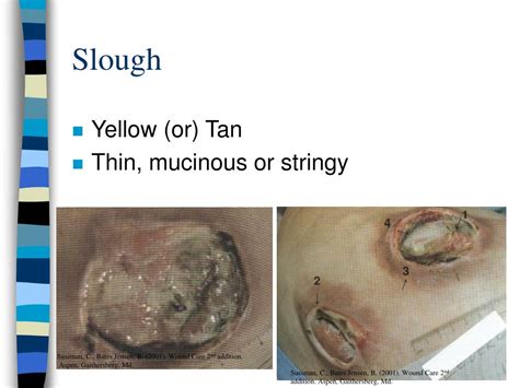 PPT - Integumentary System & Wound Symposium PowerPoint Presentation - ID:603981