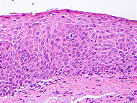 Conjunctival Histology