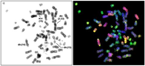 Chromosome aberrations studied by Multiplex-FISH (M-FISH) method ...