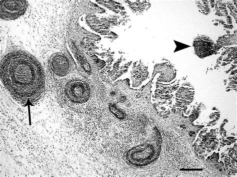 Placenta, bovine. Photomicrograph showing multifocal areas of chorionic... | Download Scientific ...