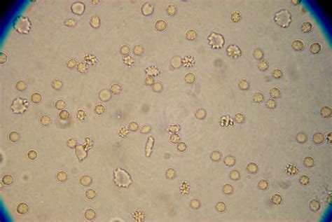 Blood Cells In Urine : Biological Science Picture Directory – Pulpbits.net