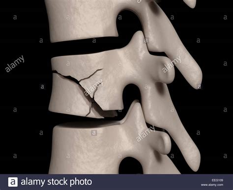 C Body High Resolution Stock Photography and Images - Alamy