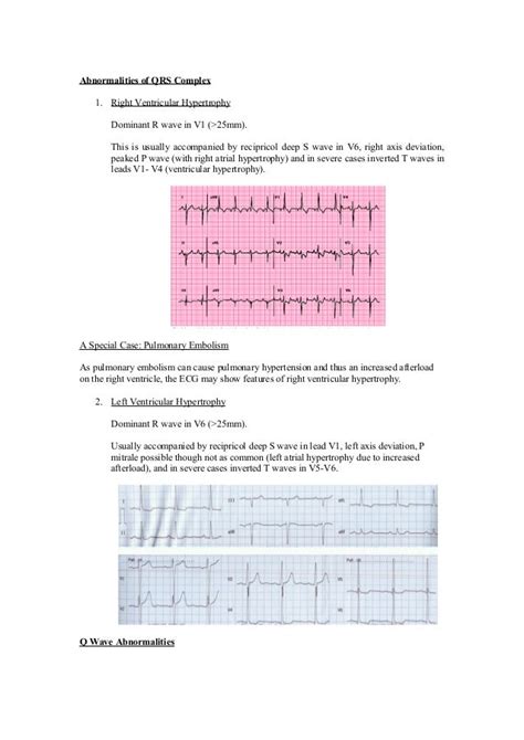 Beginners Guide for ECG Interpretation