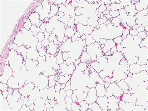 Lung Parenchyma Histology