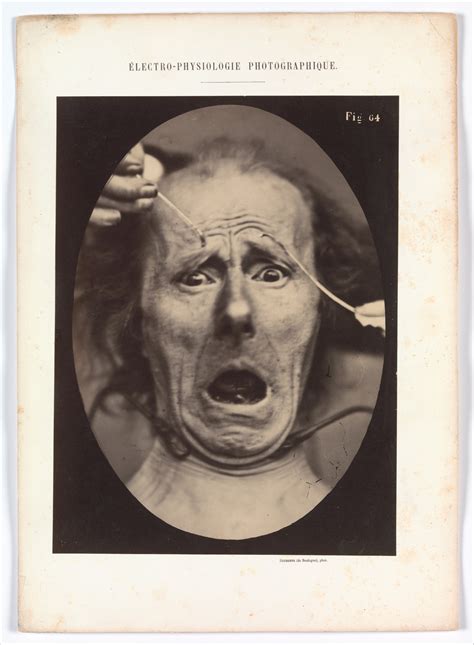 Adrien Tournachon | Electro–Physiologie, Figure 64 | The Metropolitan Museum of Art