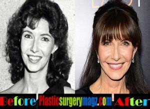 Mary Steenburgen Plastic Surgery Before and After | Plastic Surgery ...