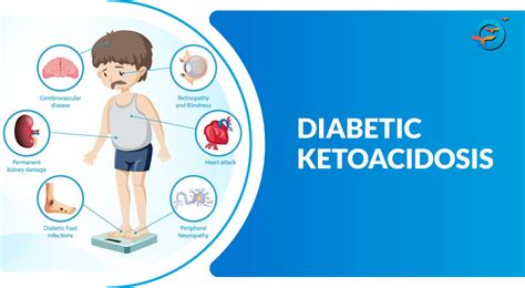 Diabetic Ketoacidosis: Causes, Symptoms, Treatment, and Prevention - Freedom from Diabetes