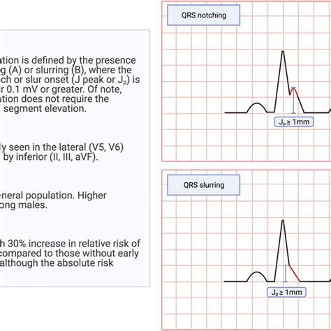 Definition, Epidemiology, and Significance of Early Repolarization ...