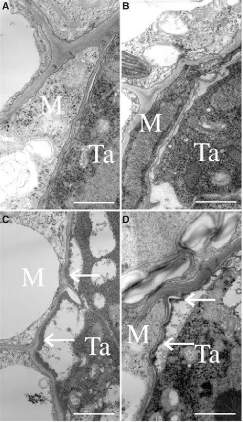 Sporopollenin accumulation on the locule wall in the wild type (A, B)... | Download Scientific ...