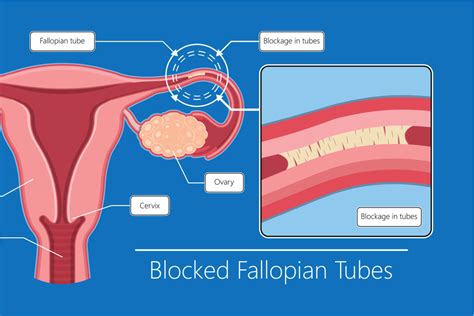 Fallopian Tube Diagram Egg