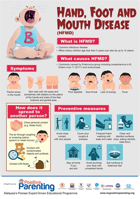 Hand, Foot and Mouth Disease (HFMD) - Positive Parenting