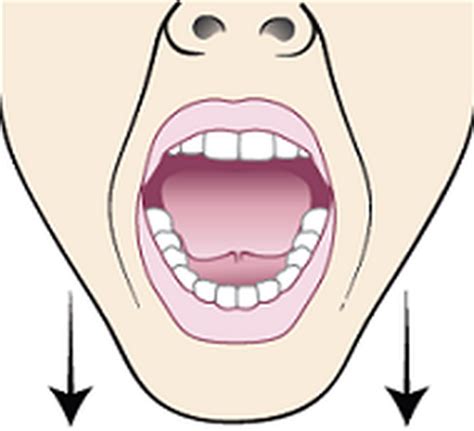 Treatment of Trismus - MEDizzy