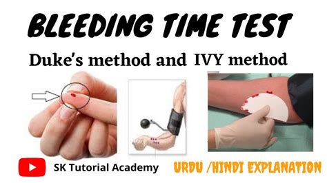 BT CT Test Bleeding Time AND Clotting Time (Coagulation, 55% OFF