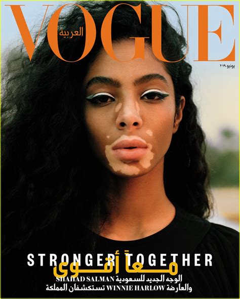 Winnie Harlow Brings Female Empowerment to 'Vogue' Arabia: Photo 4300120 | Magazine, Shahad ...