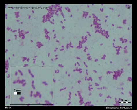 Bordetella pertussis micrograph. Gram-stained smear of Bordetella ...