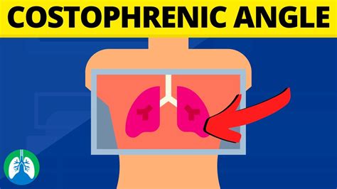 Costophrenic Angle (Medical Definition) | Quick Explainer Video - YouTube