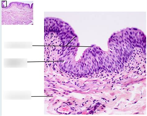 urinary bladder histology II Diagram | Quizlet