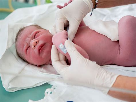 Pictures Of Premature Babies Born At 32 Weeks - PictureMeta