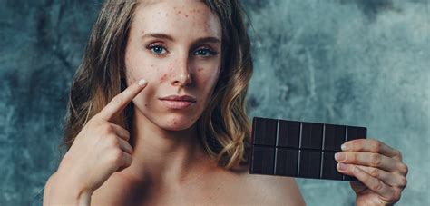 The Simple Connection Between Acne and Diet | Brian Williams Dermatology