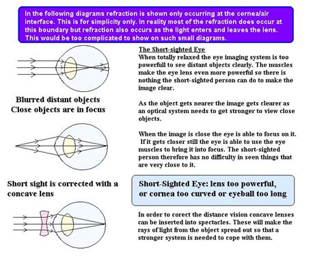 Cyberphysics - The human eye, sight defects and their correction