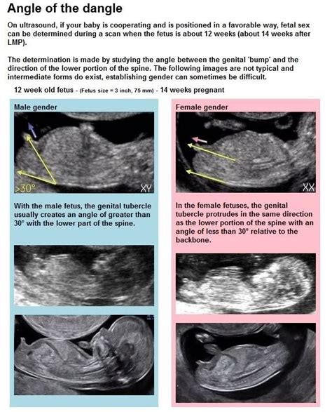 Pin on Baby After Infertility