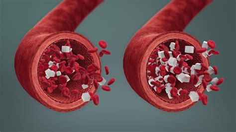 Hyperglycemia: Symptoms, Causes, Complications, and Treatment - Scientific Animations