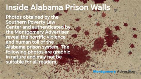 Bloody Alabama prison conditions revealed in leaked photos