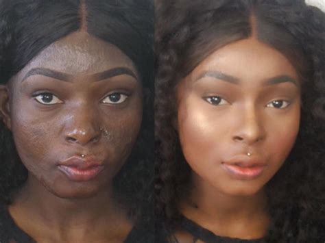 This Burn Survivor Uses Makeup In Breathtaking Ways | SELF