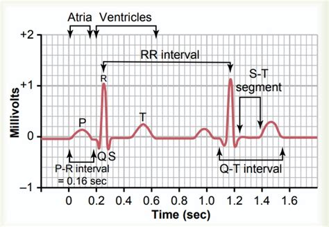 Characteristics of the Normal Electrocardiogram