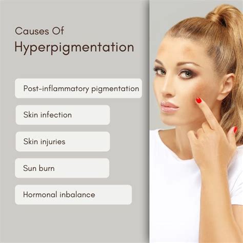 Causes of hyperpigmentation decoded - SkinQure