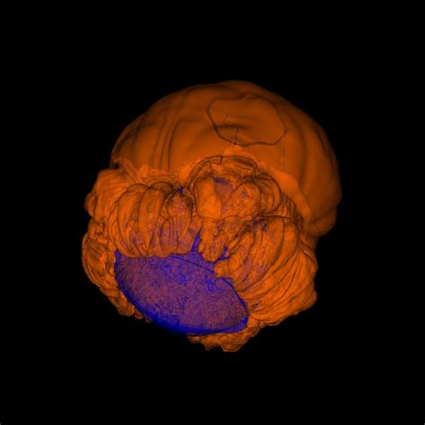 Large-Scale Simulation of a Type Ia Supernova