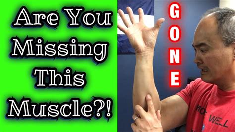 How Do You Know If You Have A Palmaris Longus? All Answers ...