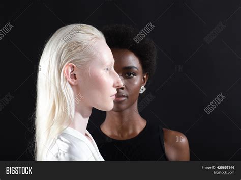 Caucasian Albino Girl Image & Photo (Free Trial) | Bigstock