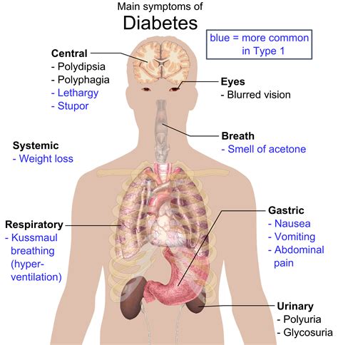 File:Main symptoms of diabetes.png