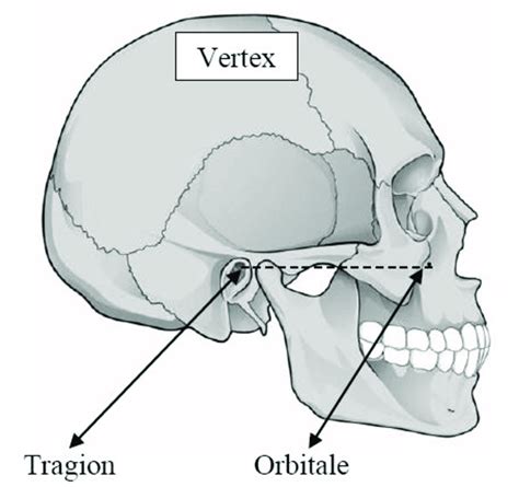 The head located in the Frankfort plane. | Download Scientific Diagram