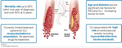 What Is Critical Limb Ischemia? - Hemostemix