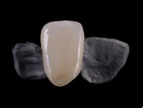 Top-quality ﻿Maryland Bridge ﻿ | Eurasia FDA-Certified Dental Lab itle