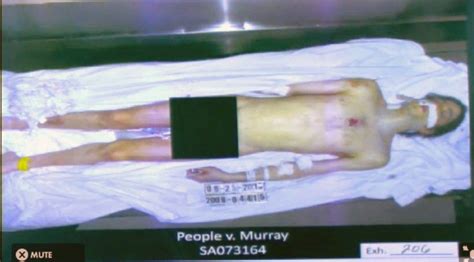 Michael Jackson Death Trial: Graphic Autopsy Image Released by ...