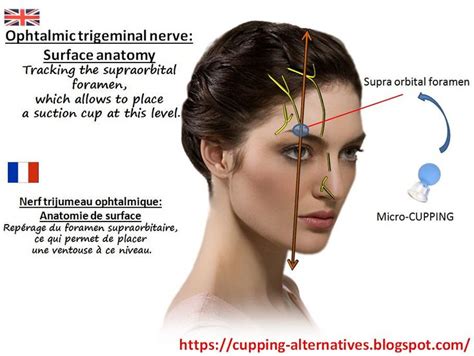 Tracking emergence supraorbital nerve | Supraorbital nerve, Cranial ...