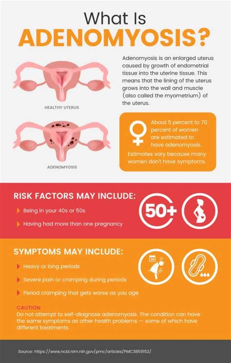 Adenomyosis: Enlarged Uterus Causes (+ Natural Relief) - Dr. Axe | Adenomyosis treatment, Uterus ...