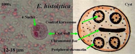 Entamoeba histolytics Microbiology Lab, Medical Laboratory Scientist, Microscopic Images, Med ...